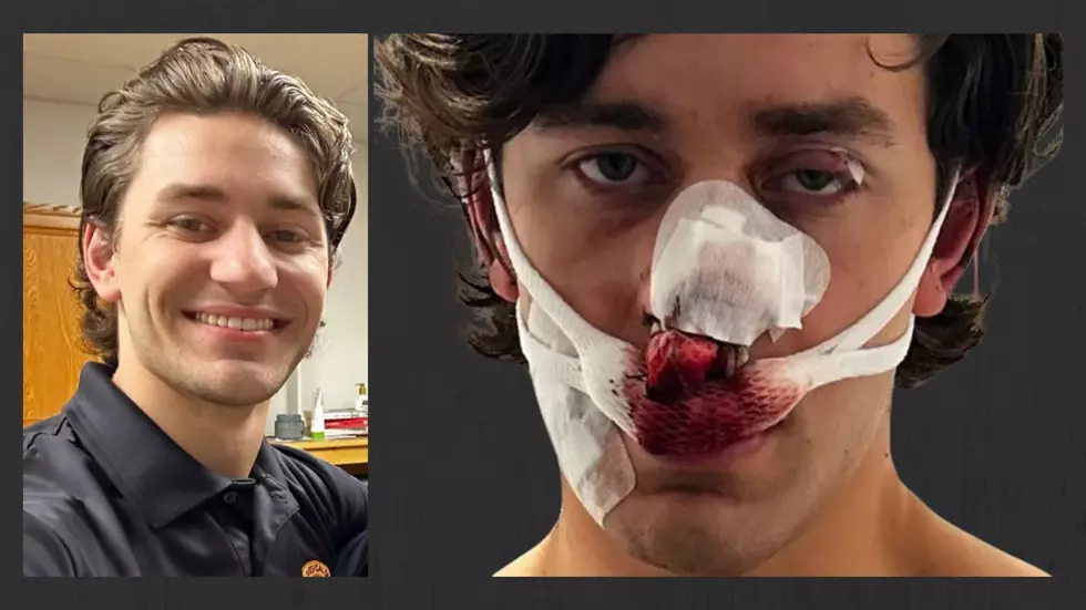 Support Grows for Colonie Man Slashed in Face After Saving Women in Germany
